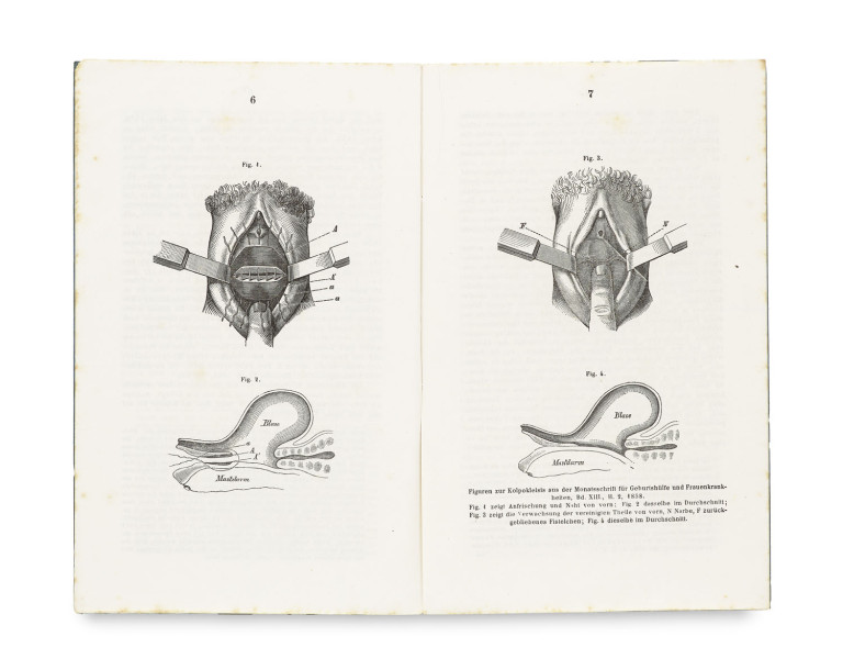 Image:
                        Lot 1562